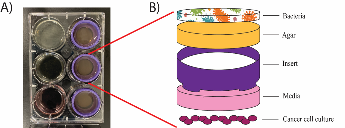Microbiome cancer cell stack pictorial