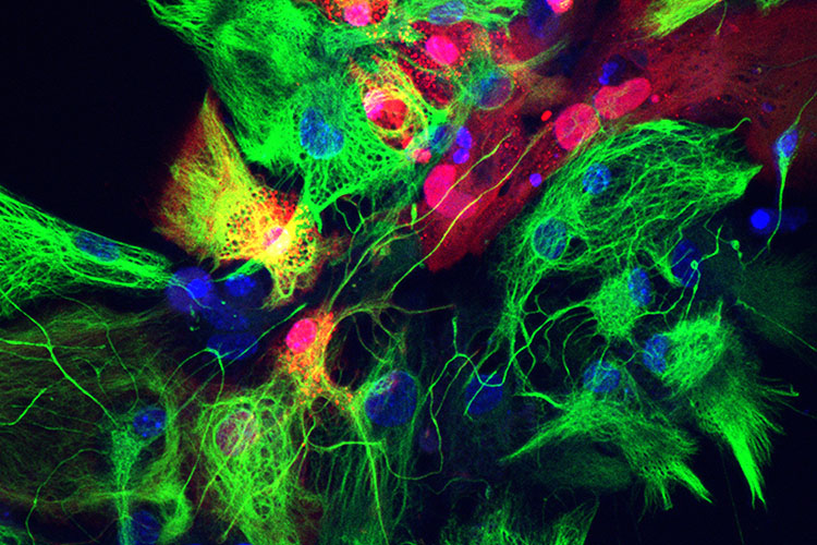 Red, blue and green neurons.